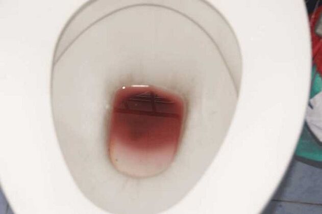 heyecanlandığında erkeklerde lekelenme